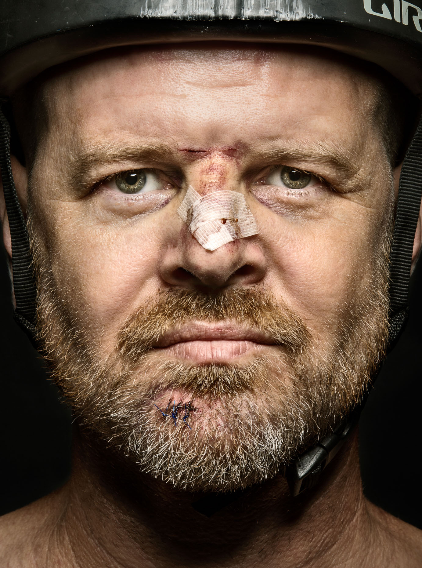 Self portrait one day after being hit by a car on my bicycle, showing the Giro bike helmet that saved my frontal lobe. Brett Deering Photography