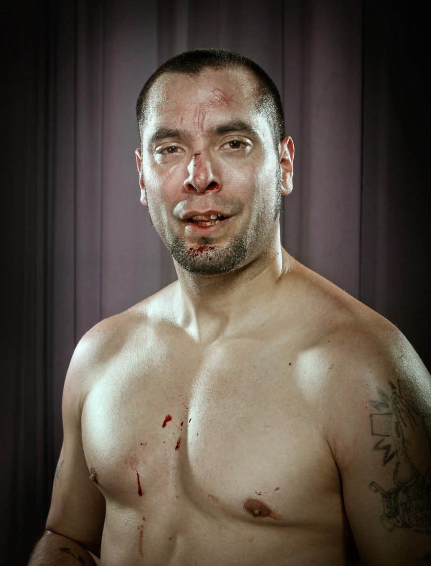 MMA fighter post fight. This particular fighter didn